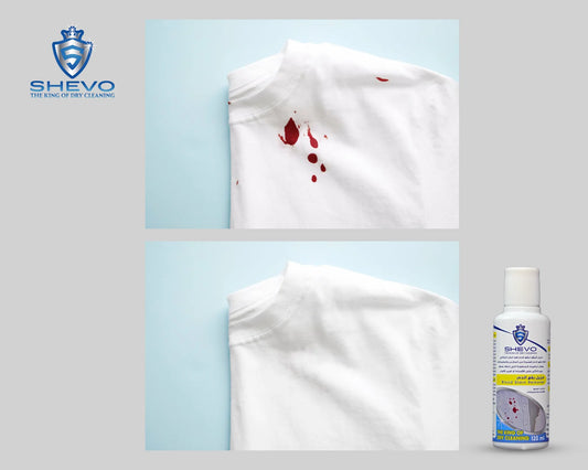 مزيل بقع الدم